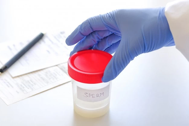 اسپرموگرام سا سمن چیست؟ چگونه آزمایش آنالیز اسپرم با تحلیل و بررسی کنیم؟
